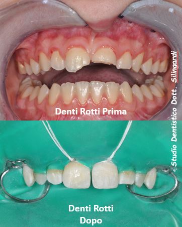 DentiRotti_new