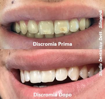 Discromia_NEW