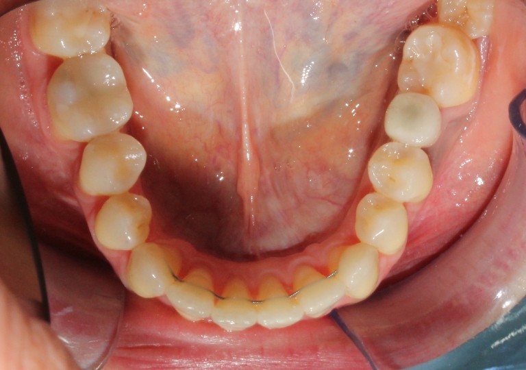 Ortodonzia Paziente Adulto